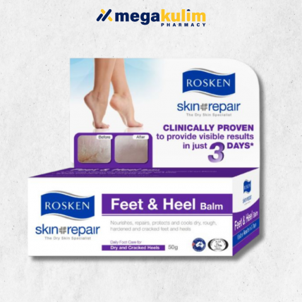 Rosken Feet & Heel Balm (50g)