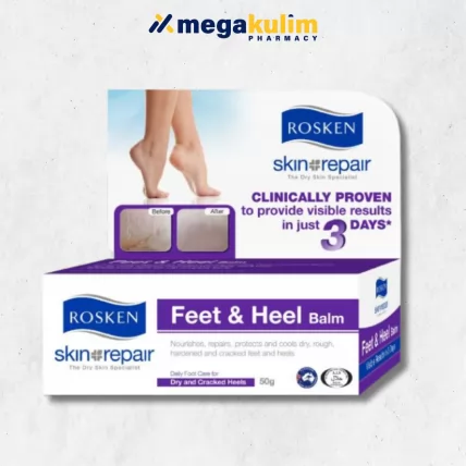 Rosken Feet & Heel Balm (50g)